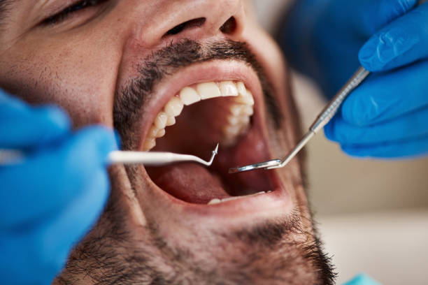 Best Emergency Treatment for Dental Infections or Abscesses in Hamlet, IN